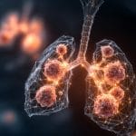 Electrical Activity as a Hidden Engine in Lung Cancer